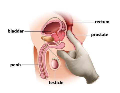 Prostatas masāža